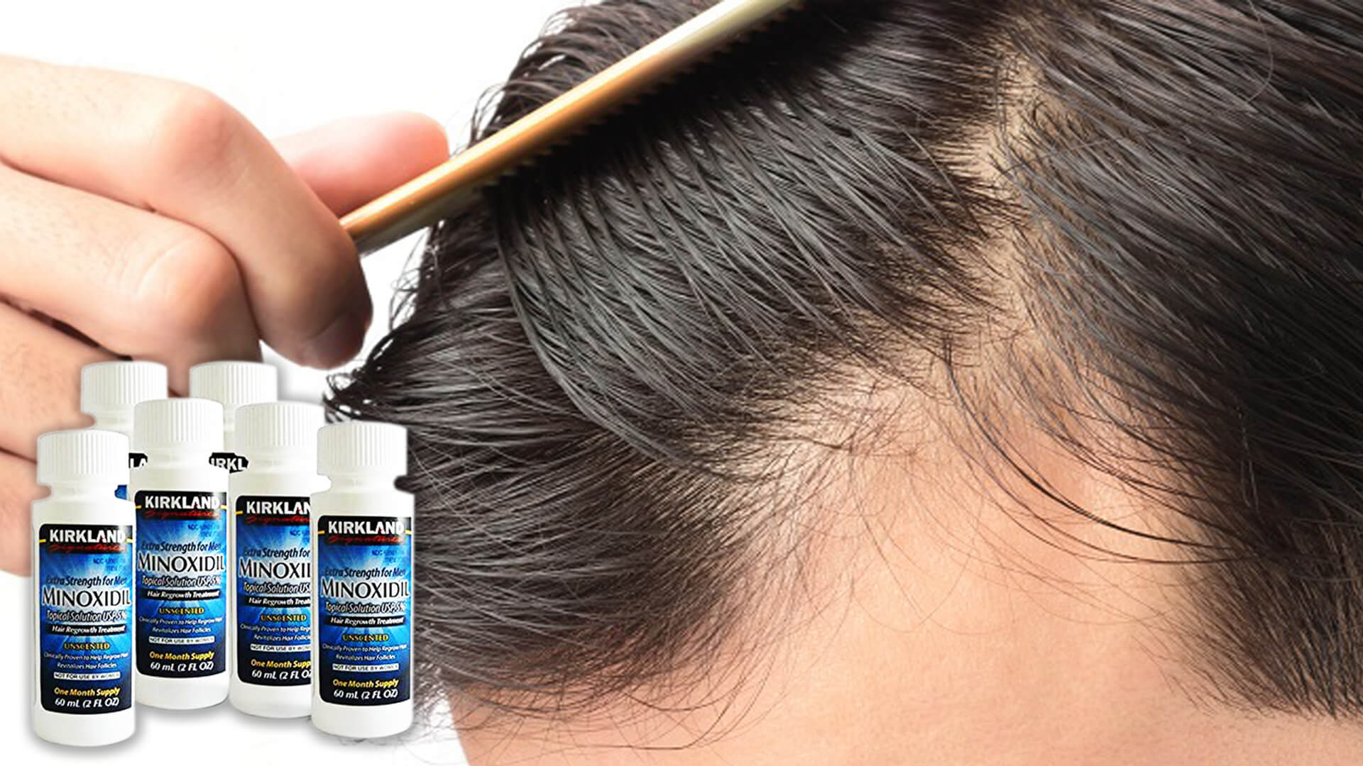 Can You Maintain Minoxidil Grown Hair After Stopping Minoxidil